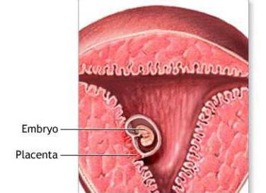 Grossesse, 6 semaines. Décharge brune sans douleur: que faire?