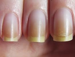 comment blanchir les ongles à la maison