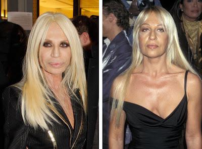 Donatella Versace avant et après