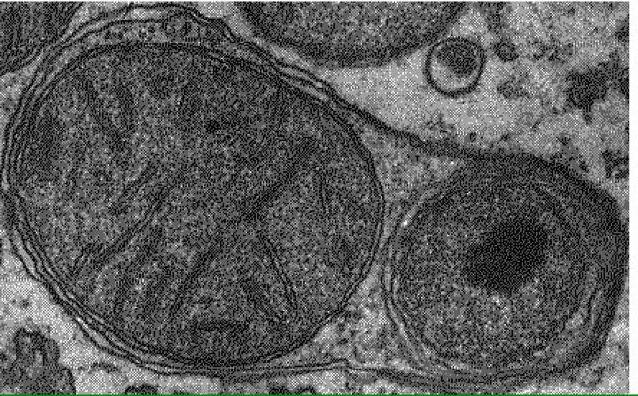 lysosome structure et fonction brièvement