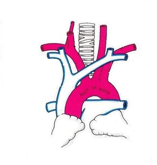 anatomie de l'aorte 