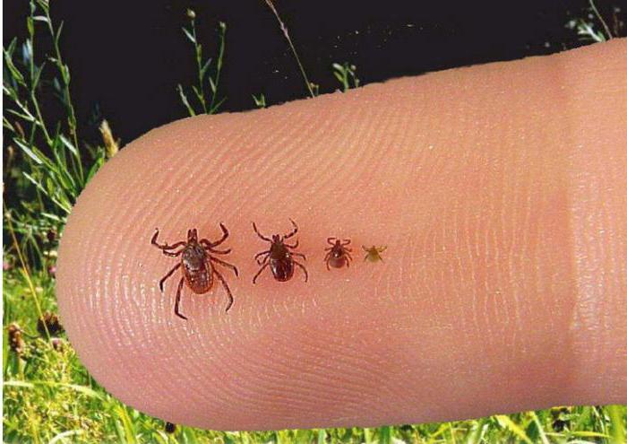 tweezer ticks critiques 