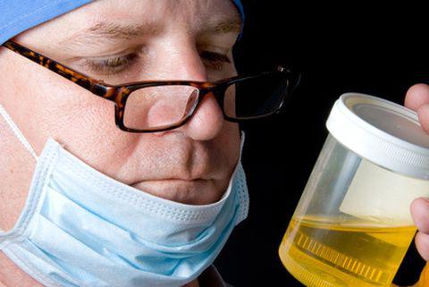 Comment soumettre un test d'urine correctement?
