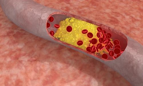 quels aliments réduiront le cholestérol