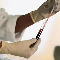 La norme du test sanguin, quelle est sa signification