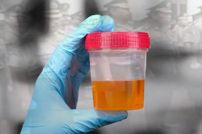 cylindres granulaires dans l'urine