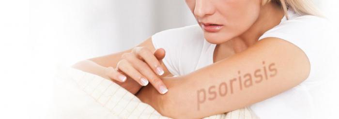 le psoriasis est transmis ou non