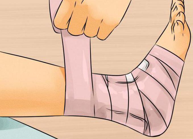 Ankle stamping: comment cela se fait-il, quand est-ce nécessaire?