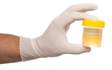 La gravité spécifique de l'urine en norme et en pathologie